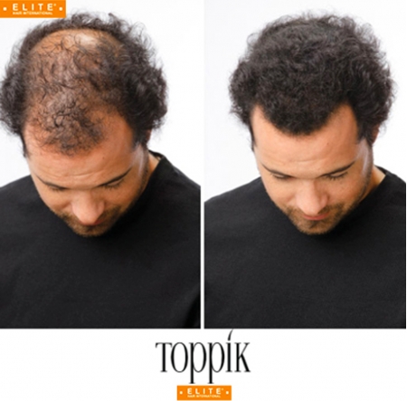 Poudre Toppik, masquer perte cheveux, calvitie, homme, femme, Elite Hair International