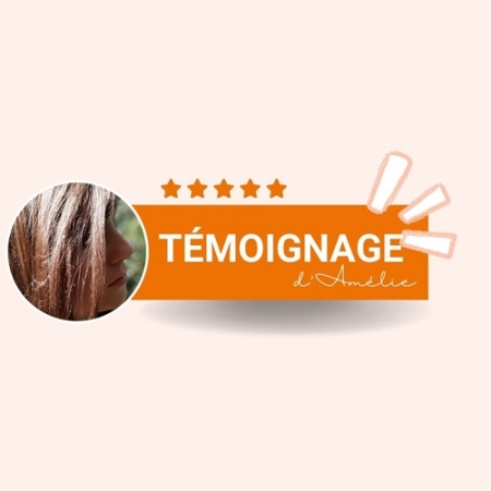 Témoignage : L’histoire d’Amélie, atteinte de pelade depuis ses 12 ans Témoignage : L’histoire d’Amélie, atteinte de pelade depuis ses 12 ans